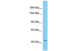 Host:  Rabbit  Target Name:  GREB1  Sample Type:  Pancreas Tumor lysates  Antibody Dilution:  1. (GREB1 antibody  (N-Term))