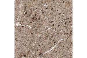 Immunohistochemical staining of human cerebral cortex with SHROOM4 polyclonal antibody  shows strong cytoplasmic positivity in neuronal cells at 1:50-1:200 dilution. (Shroom Family Member 4 (SHROOM4) antibody)