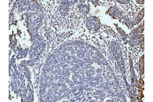 IHC analysis of ARL6IP6 using anti-ARL6IP6 antibody (ABIN7603020). (ARL6IP6 antibody  (Middle Region))