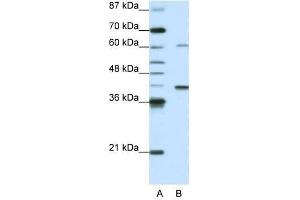 MGC46336 antibody used at 0. (ZNF843 antibody  (N-Term))