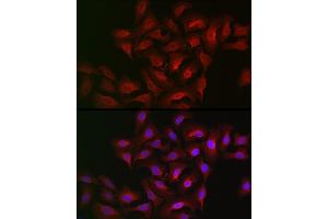 Immunofluorescence analysis of U2OS cells using B Rabbit pAb (ABIN6129899, ABIN6136816, ABIN6136817 and ABIN6222589) at dilution of 1:100 (40x lens). (ALOX15B antibody  (AA 1-200))