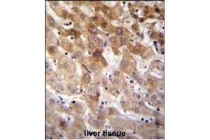 MBTD1 Antibody (C-term) (ABIN655319 and ABIN2844896) immunohistochemistry analysis in formalin fixed and paraffin embedded human liver tissue followed by peroxidase conjugation of the secondary antibody and DAB staining. (MBTD1 antibody  (C-Term))
