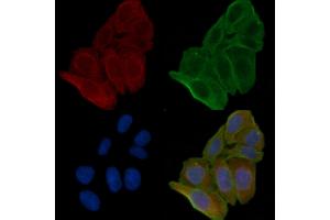 ABIN6262776 and ABIN6266570 staining Hela cells(24h of starvation treatment) by IF/ICC.