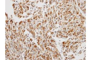 Immunohistochemistry (IHC) image for anti-Eukaryotic Translation Elongation Factor 1 beta 2 (EEF1B2) antibody (ABIN2856398)