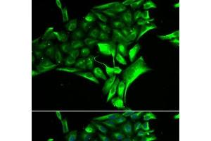 Immunofluorescence analysis of MCF-7 cells using PYGB Polyclonal Antibody (PYGB antibody)
