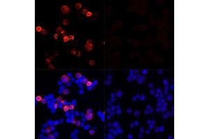 Immunofluorescence analysis of 293T cells transfected with SARS-CoV-2 Spike protein and untreated 293T cells use SARS-CoV-2 Spike Rabbit pAb (ABIN7266506) at dilution of 1:100 (40x lens). (Coronavirus Spike Glycoprotein antibody)