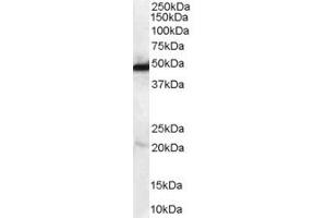 Western Blotting (WB) image for anti-N-Myc Downstream Regulated 1 (NDRG1) (C-Term) antibody (ABIN2465988) (NDRG1 antibody  (C-Term))
