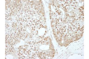 Immunohistochemistry (IHC) image for anti-Zinc Finger and BTB Domain Containing 40 (ZBTB40) (AA 1140-1190) antibody (ABIN7453490)