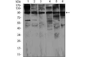 Western blot analysis using NOS2 mouse mAb against Jurkat (1), Jurkat (2), A549 (3), HeLa (4), NIH3T3 (5)and MCF-7 (6) cell lysate. (NOS2 antibody)