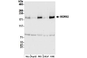 Western Blotting (WB) image for anti-WD Repeat Domain 62 (WDR62) (AA 900-950) antibody (ABIN7450905)