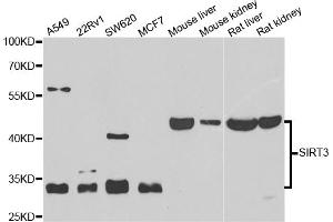 Western blot analysis of extracts of various cell lines, using SIRT3 antibody (ABIN5974409) at 1/1000 dilution. (SIRT3 antibody)