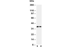 Western blot testing of Calbindin antibody (0. (CALB1 antibody  (AA 2-175))