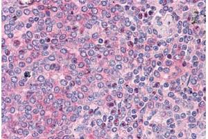 Human Spleen: Formalin-Fixed, Paraffin-Embedded (FFPE) (ADAM17 antibody  (AA 215-315))