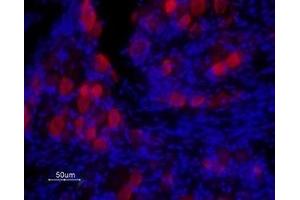 Expression of TRPV1 in rat DRG - Immunohistochemical staining of rat dorsal root ganglion (DRG) frozen sections using Anti-Rat TRPV1 (VR1) (extracellular) Antibody (ABIN7043838, ABIN7043986 and ABIN7043987), (1:100) followed by goat anti-rabbit-ATTO Fluor-594 secondary antibody (red). (TRPV1 antibody  (3rd Extracellular Loop, Cys616))