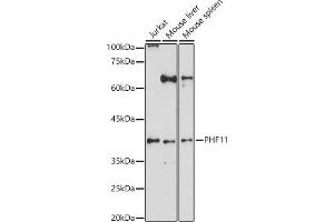 Western blot analysis of extracts of various cell lines, using PHF11 antibody (ABIN6128438, ABIN6145534, ABIN6145536 and ABIN6223765) at 1:1000 dilution. (PHF11 antibody  (AA 1-292))