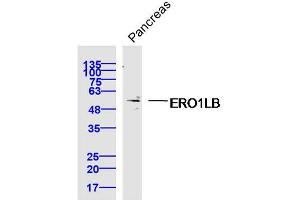 Mouse pancreas lysates probed with ERO1LB Polyclonal Antibody, Unconjugated  at 1:300 dilution and 4˚C overnight incubation.