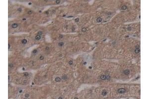 Detection of AATK in Human Liver Tissue using Polyclonal Antibody to Apoptosis Associated Tyrosine Kinase (AATK) (AATK antibody  (AA 1216-1374))