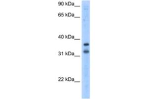 Western Blotting (WB) image for anti-Potassium Channel Regulator (KCNRG) antibody (ABIN2461173) (KCNRG antibody)
