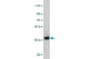 Western Blot detection against Immunogen (32. (POMC antibody  (AA 205-267))