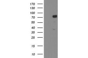 Western Blotting (WB) image for anti-Katanin P80 (WD Repeat Containing) Subunit B 1 (KATNB1) antibody (ABIN1498987) (KATNB1 antibody)