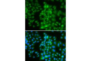 Immunofluorescence analysis of HeLa cell using LMO4 antibody. (LMO4 antibody)