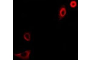 Immunofluorescent analysis of CD66f staining in A549 cells. (PSG1 antibody)