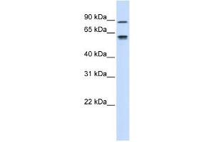 EFEMP1 antibody used at 1 ug/ml to detect target protein. (FBLN3 antibody  (Middle Region))