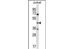 Western blot analysis in Jurkat cell line lysates (35ug/lane). (ASS1 antibody  (C-Term))