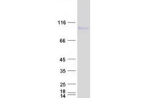 Validation with Western Blot (DISC1 Protein (Transcript Variant L) (Myc-DYKDDDDK Tag))
