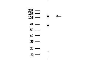 anti-Collagen, Type VI, alpha 2 (COL6A2) (Internal Region) antibody