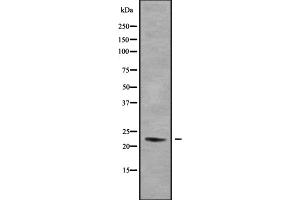 Western blot analysis of DUX5 using HeLa whole cell lysates (DUX5 antibody  (N-Term))