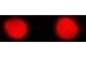 Immunofluorescent analysis of RbAp48 staining in MCF7 cells. (Retinoblastoma Binding Protein 4 antibody)