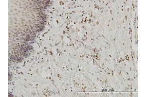 Immunoperoxidase of monoclonal antibody to HYI on formalin-fixed paraffin-embedded human esophagus. (HYI antibody  (AA 1-217))