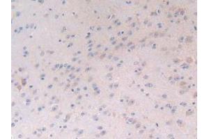 Figure. (LTBP1 antibody  (AA 1415-1712))