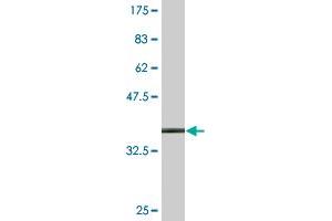 Western Blot detection against Immunogen (35. (DYRK1B antibody  (AA 479-569))