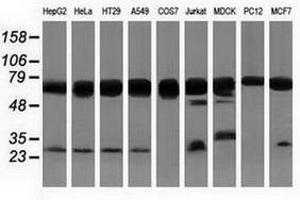 Image no. 3 for anti-Pseudouridylate Synthase 7 Homolog (PUS7) antibody (ABIN1500514) (PUS7 antibody)