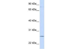 PCDHGC3 antibody used at 1 ug/ml to detect target protein. (Protocadherin gamma Subfamily C, 3 (PCDHGC3) (N-Term) antibody)
