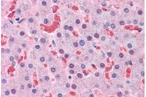 Human Liver: Formalin-Fixed, Paraffin-Embedded (FFPE) (Hemoglobin Subunit beta antibody  (AA 38-148))