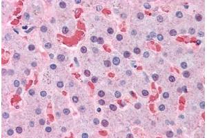 Human Liver: Formalin-Fixed, Paraffin-Embedded (FFPE) (Hemoglobin Subunit beta antibody  (AA 38-148))