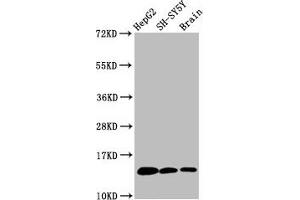 Western Blot Positive WB detected in HepG2 whole cell lysate 83H-SY5Y whole cell lysate 82at brain tissue All lanes Mono-methyl-Histone H3. (Recombinant HIST1H3A antibody  (H3K36me))