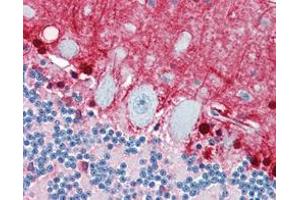 Immunohistochemical analysis of paraffin-embedded human brain, cerebellun using S100B mouse mAb with DAB staining. (S100B antibody)