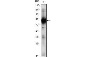 Western blot analysis using RAG2 mouse mAb against RAG2(AA: 350-527)-hIgGFc transfected HEK293 (1)cell lysate. (RAG2 antibody  (AA 350-527))