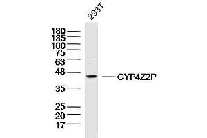 293T lysates probed with CYP4Z2P Polyclonal Antibody, Unconjugated  at 1:300 dilution and 4˚C overnight incubation. (CYP4Z2P antibody  (AA 51-150))