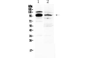 Western blot analysis of NFAT2 using anti-NFAT2 antibody . (NFATC1 antibody  (AA 589-652))
