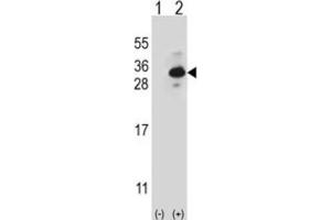 Western Blotting (WB) image for anti-Clathrin, Light Chain B (CLTB) antibody (ABIN2997028) (CLTB antibody)