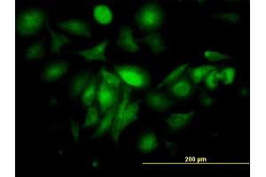 Immunofluorescence of monoclonal antibody to FTL on HeLa cell. (FTL antibody  (AA 1-175))