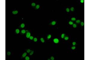 Immunofluorescence staining of Hela cells with ABIN7139605 at 1:7. (HIST1H4A antibody  (meLys59))