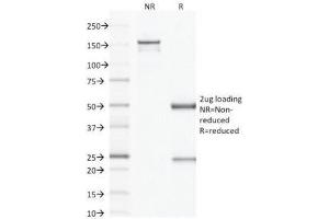 SDS-PAGE Analysis of Purified, BSA-Free Factor XIIIa Antibody (clone F13A1/1683).