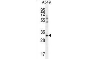 Western Blotting (WB) image for anti-Solute Carrier Family 25 (Mitochondrial Carrier, Adenine Nucleotide Translocator), Member 6 (SLC25A6) antibody (ABIN2996577) (SLC25A6 antibody)