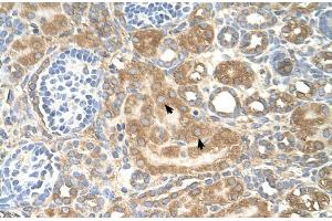 Human kidney (SPTLC1 antibody  (Middle Region))